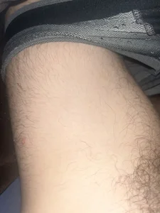 Goldendickinyou Bein Pic