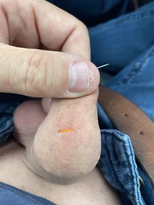 Sklavekay Public Pic 3