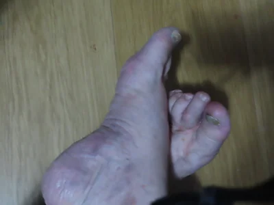 StiveMartin PÉS Immagine 