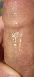 davidkigyoPublic Bild