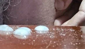 jhonschen's Gli fa male il sole Sex Photo 1