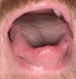 Fredneck54 Public  2টি ছবি