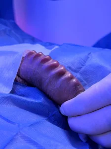 alexander-lacos Polla pearling Pic 2