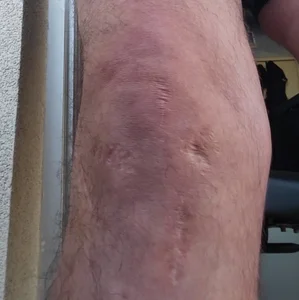 panda_06200 my scars Billede 3