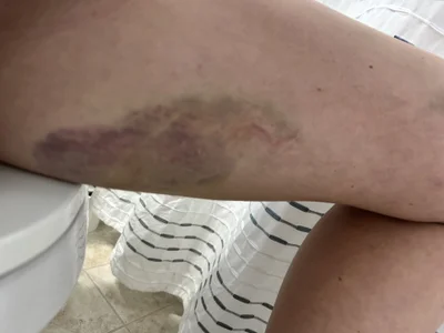 MissMaggie Bad accident Foto 4