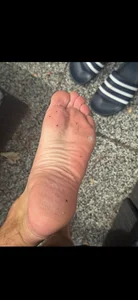 IAMSweetHoney Feet Pic 2