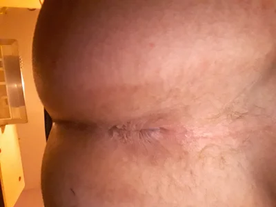 AcAb131277 xXx Εικόνα 4