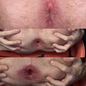 hirtrix2 Public Pic 2