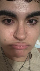 Monst3rc00ck A summary of the worst year of my life (at least I looked pretty) Foto 2
