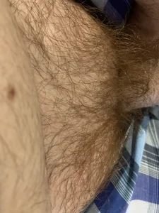 milan1515 Night Hairy Red Thick Dick Foto