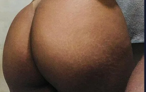 Mayllastrip Dlç Foto