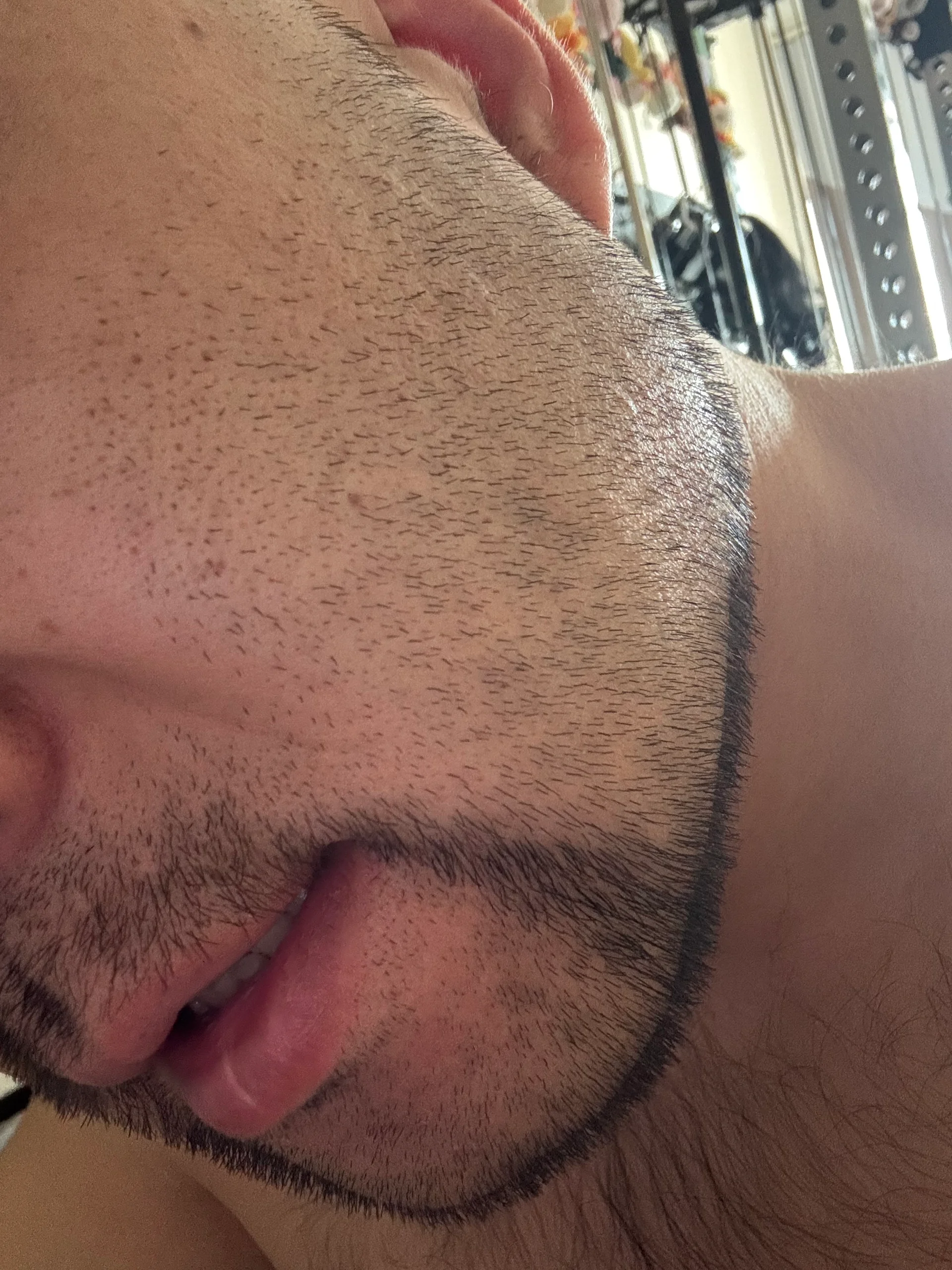 Xdxxdxx333 Public Bilde 2