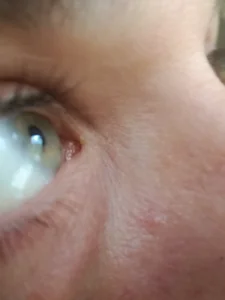 Public de Ninfo920817  5 Imagens