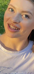 RinaBlondie BRACES TIME Pic 5