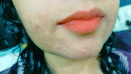 Niha_kannada Public Immagine  5