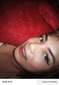 Zdjęcia Martha4you Braces 💗:  3