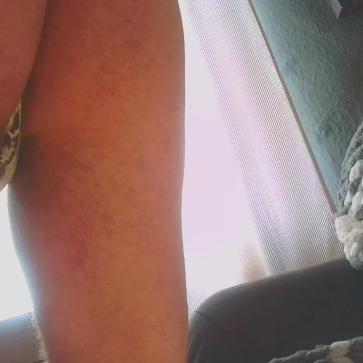 T0Yforeskin избранные изображения 6136