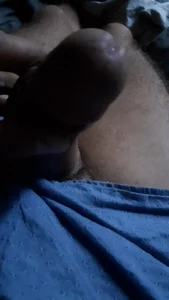 Littlesticky@xhs XXX-Nackfoto 3
