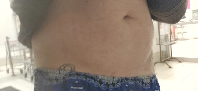 BulbasaurIsmettv Public صورة واحدة|BulbasaurIsmettv Public صورتان|BulbasaurIsmettv Public  صور|BulbasaurIsmettv Public  صورة