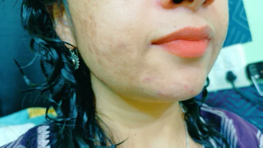 Public de Niha_kannada  3 Imagens