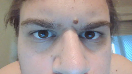 Rennato27 Public Billede