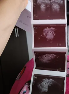 mia1199 baby on Board Pic 2