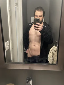 foreskinfred01 Public . fénykép