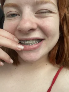 RinaBlondie BRACES TIME Pic 2