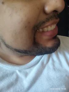 Hotknight Lips Poză