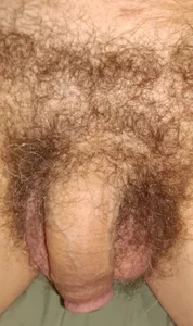 Aluntrus@xh Public Foto 3