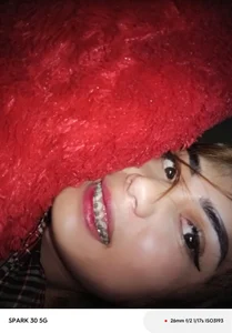 Zdjęcia Martha4you Braces 💗: 