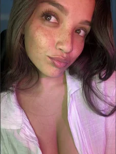 MisFrekcles_ My eyes 🫶🏻 Immagine 