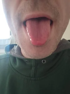 openlegsforyou Free Immagine  2