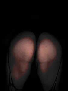 Public de CatDogAlexxx  2 Imagens