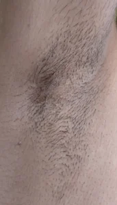 balio1 Tease Pic