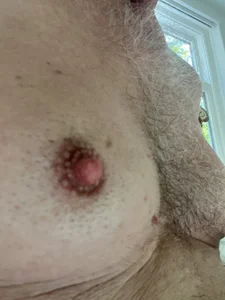 Foreskin & nipple pics de martxxxxx Foto 2