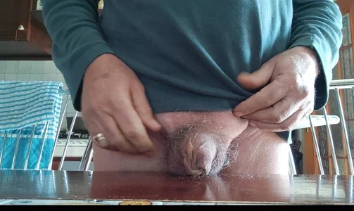 jhonschen's Allargamento prepuzio da 2 cm Sex Photo 3