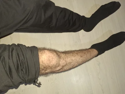My hairy legs de virginhairyboy20  photos