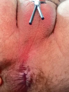 Public de FungodeBoy  2 Imagens