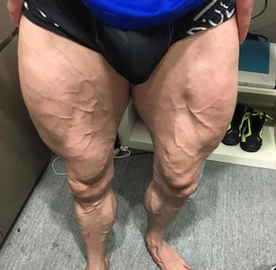 muscle_model33 kullanıcısının Public albümü -  6 fotoğraf