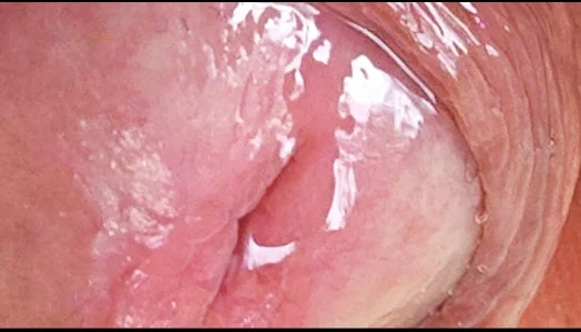 jhonschen's Preiaculazione primo piano Sex Photo 3
