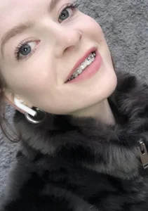 RinaBlondie BRACES TIME Pic 3