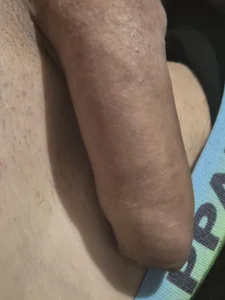 TwoDirtyFlamesPublic Bild