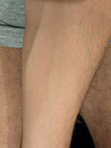 Miles99Public Bild 2