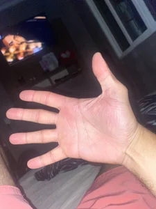 Mãos de Didi3699  Imagens