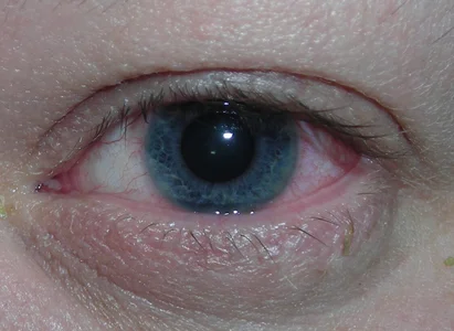 hadeszeuss2 ojos 1 - eyes 1 รูป 