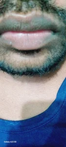 sudhastriper For my friend Foto