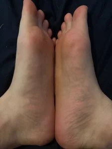 Pieds de Mecvierge  7 Imagens