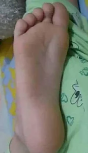 SUDOR20FEET Pies 사진 4