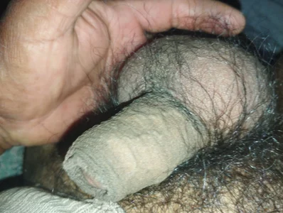 alcoan3 kullanıcısının Te gusta albümü -  fotoğraf